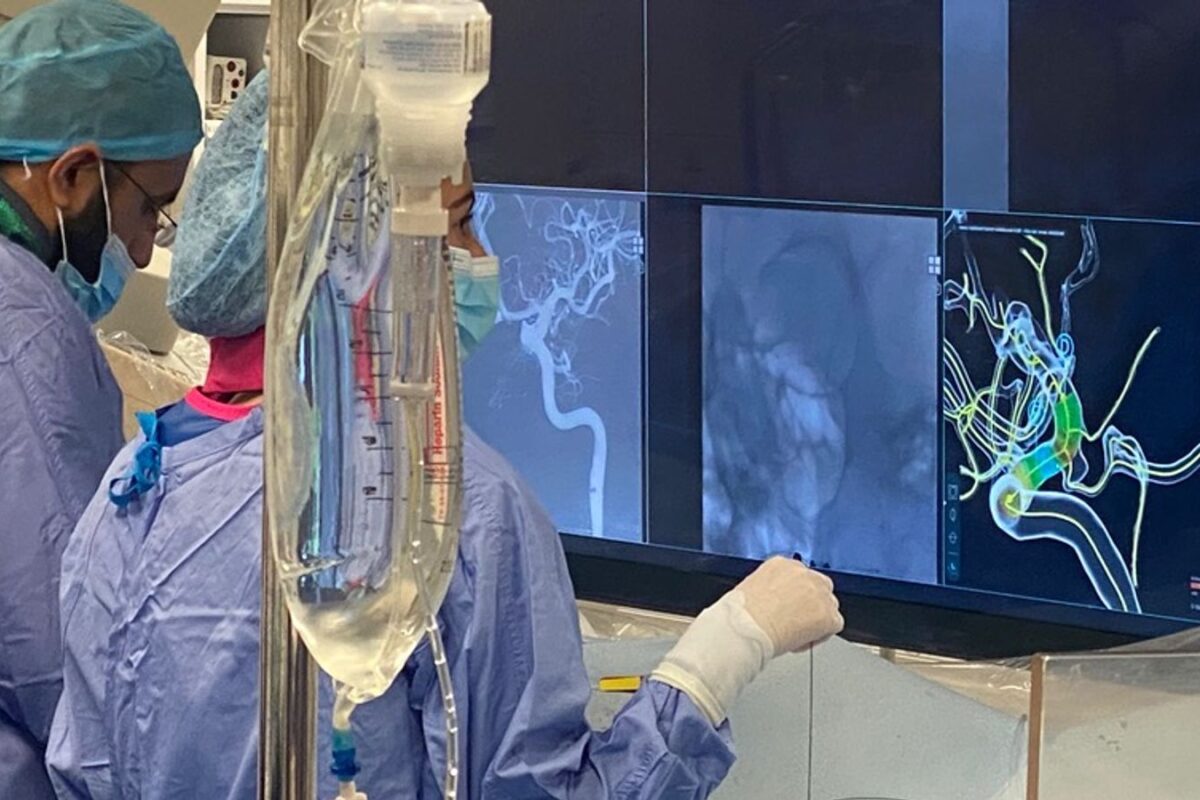 AI-Driven Technology Holds Promise of Transforming Aneurysm Treatment