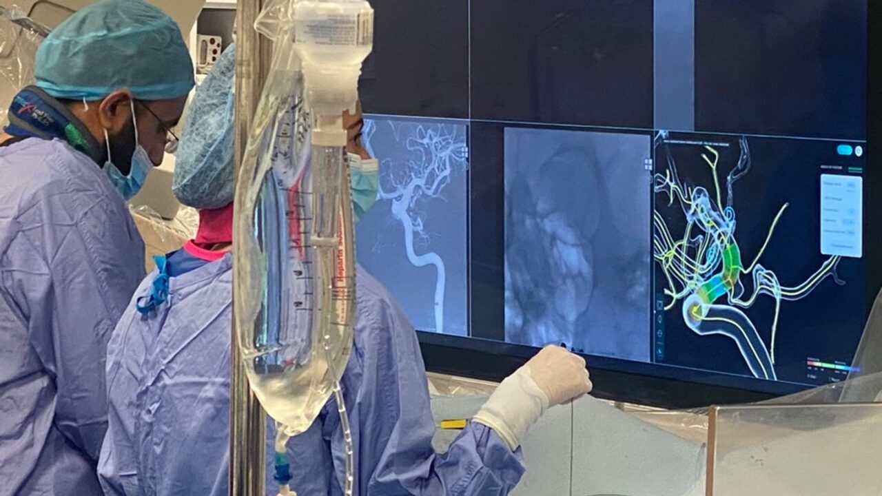 AI-Driven Technology Holds Promise of Transforming Aneurysm Treatment